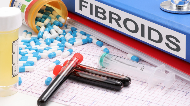 Fibroid